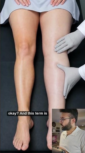 DVT and Phlegmasia After Hip Replacement