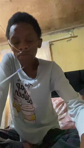 Help Needed for Accessing Pulmonologist Care