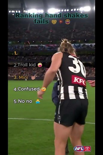 He Broke His Hand With Just a Handshake 💀🤝