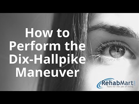 How to Perform the Dix-Hallpike Maneuver for Vertigo