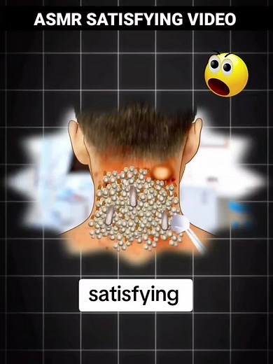 Relax Every Day With Sac Dep Spa | 76 | #acne #blackheads #whiteheads #Treatments #pimple