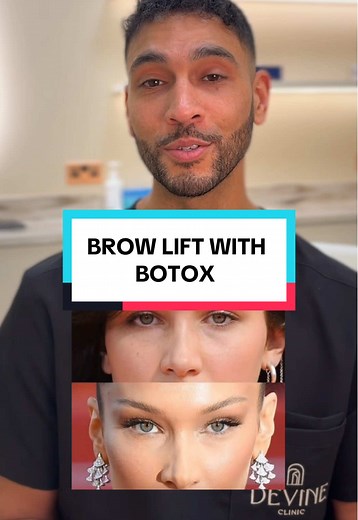Enhance Your Look with Botox Brow Lift Techniques