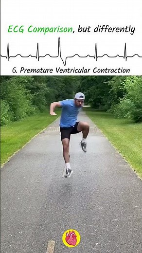 ECG rhythm comparison but hilariously different #ecg #ecginterpretation #cardiology