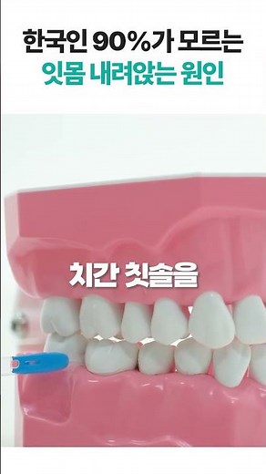 [위덴] 한국인 90%가 모르는 잇몸 내려앉는 원인