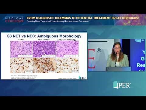 Exploring Novel Targets for Extrapulmonary Neuroendocrine Carcinomas