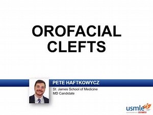 Our Express Video of the Week covers orofacial clefts, from the Embryology section of the Reproductive chapter in First Aid for the USMLE Step 1. If you want to sample more of the over 80 hours of video we deliver in USMLE-Rx, sign up for our free 5-day trial: usmle-rx.com. #LoveHowYouLearn | USMLE-Rx