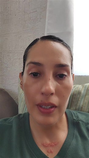 Estoy harta!! #sintiroides #hipotiroidismo #hipertiroidismo #ejercicio | Hyperthyroidism