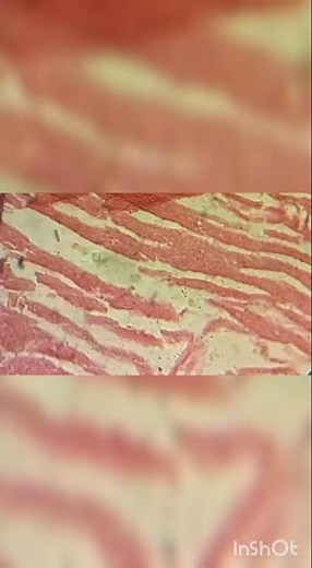 Cardiac muscle under microscope- Histology slide show