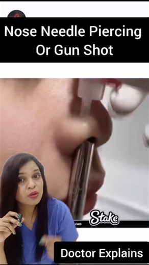 Dr Ramya Nalli | ENT, Sleep & Facial Cosmetic Surgeon 🔵 on Instagram: "When considering nose or ear piercings, it's essential to understand the differences between the two primary methods: needle cannula and piercing gun. **Needle Cannula Piercing:** - **Process:** A hollow, sharp needle creates a clean hole by removing a small tissue sample, minimizing trauma. citeturn0search4 - **Advantages:** - **Precision:** Allows for accurate placement, especially beneficial for cartilage piercings. 