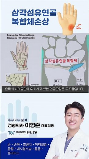 [청주탑병원]건강TV-삼각섬유연골복합체손상#청주정형외과 #청주탑병원#TFCC