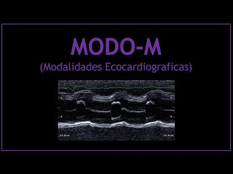MODO-M (Modalidades Ecocardiograficas)!
