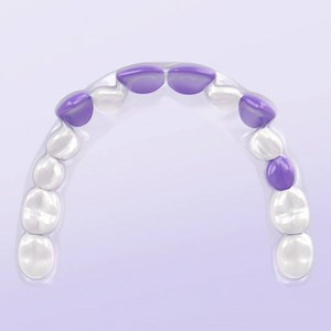 1K reactions · 104 shares | We straighten teeth for up to 60% less with clear aligners delivered direct to you. Take our smile assessment and see if you're a candidate. | Smile Direct Club | Facebook