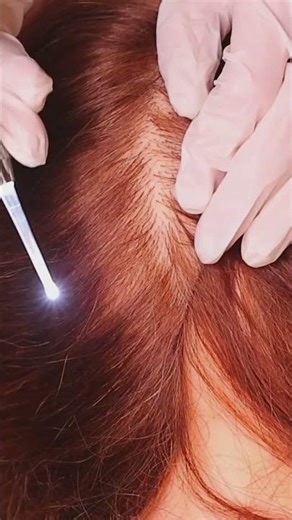 ASMR Nit picking #triggersforsleep #asmr #asmrforanxiety #visualtingle #relaxing #hair