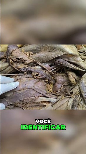 Anatomy of the uterus