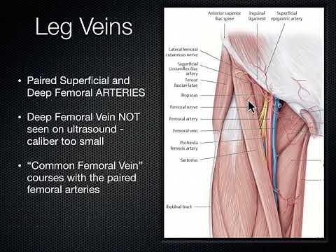 DVT Ultrasound/ deep vein thrombosis