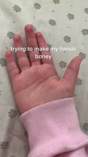 I promise I did more after making this😭😭 #boneyhands #handexercises #fyp #cat