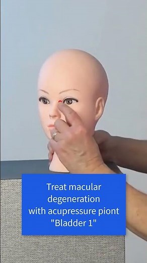 #MacularDegeneration - Acupressure in 60 Seconds