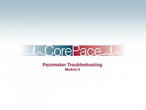 Pacemaker Troubleshooting Module 9 - SlideServe