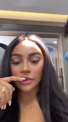 Veneers check #veneers