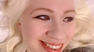 Albino woman, 20, opens up about what it's really like to live with the condition