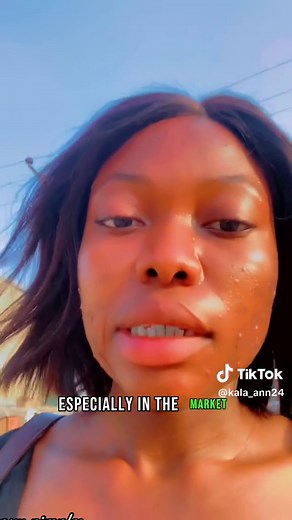 How to Clear Your Pimples Naturally & Fast