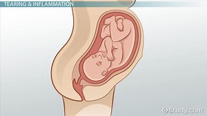 Diseases of the Vagina: Vocabulary