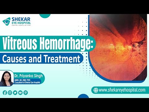 Vitreous Hemorrhage | Symptoms, Causes & Treatments of Vitreous Hemorrhage | Shekar Eye Hospital