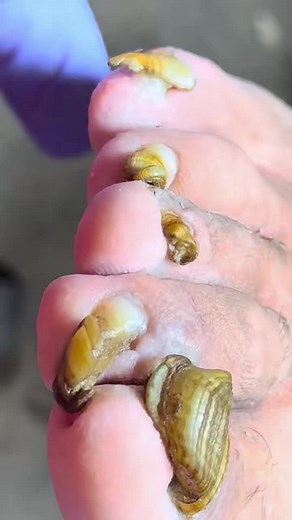 There’s something shocking inside this toenail YY91 Beautiful moments of care and relaxation through a gentle pedicure experience. Simple, clean, and satisfying. 🌿✨ Disclaimer: This video is for educational and relaxation purposes only. All content belongs to the respective owners, no copyright infringement is intended. | Finatic Gaming