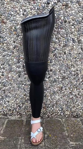 Innovative Prosthetic Solutions for Above-Knee Amputees