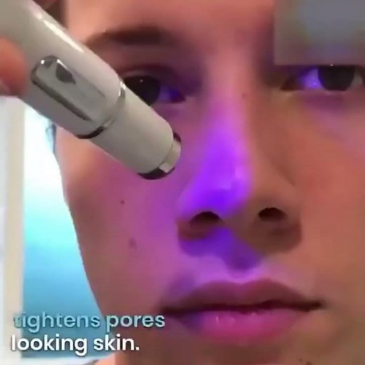 Blue Light Therapy Acne Laser Pen Soft Scar Wrinkle Removal