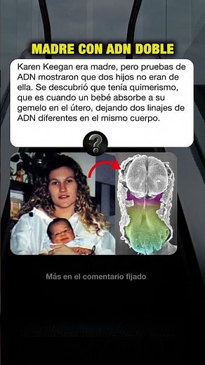 Ella tenía ADN doble #curiosidades #misterios