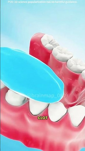 Tooth extraction procedure (3D animation) #drone #theflash #space #automobile #scifi #science
