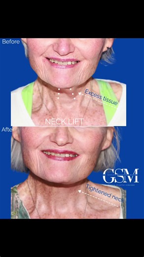 Ear Lobe Enhancements: Common Procedures Explained