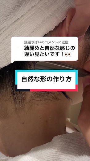 自然なうなじ＆もみあげ脱毛の方法
