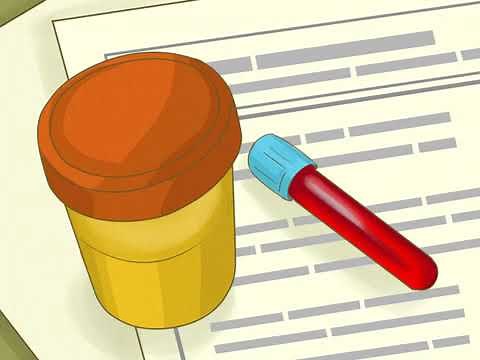 How to Pass a Tobacco Test