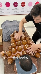 5.3K views · 12 reactions | Cup Therapy EXPLAINED  #explain #explained #facts #factsyoudidntknow #DidYouKnow #theupbeatzone #viral #viralvideo #reel #reelsinstagram #reels tiktok #tranding #fyp #EduTok #edu #ed | Go Movie | Facebook