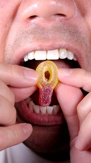 9.2K views · 349 reactions | Satisfying ASMR Gummy  #DoctorTristanPeh #ASMR #Gummy | Doctor Tristan Peh | Facebook