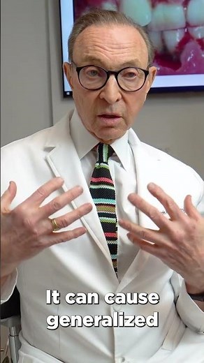 TRENCH MOUTH - What is it? How To Treat it!
