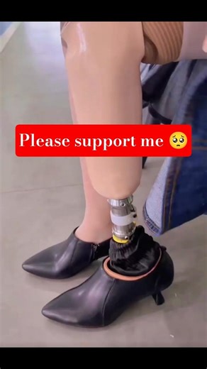 Powerful Prosthetic Journey | Never Give Up