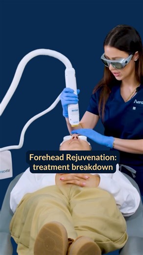 Aerolase® Healthy Energy for All Skin on Instagram: "Forehead Rejuvenation Made Simple @thehauteinjector demonstrates how the Aerolase Neo Elite delivers real results with precision, safety, and zero downtime. Using 650-microsecond Nd:YAG technology, Aerolase Neo targets melanin, hemoglobin, and water within the skin to: 🌟 Stimulate collagen remodeling 🌟 Reduce redness and pigmentation 🌟 Smooth fine lines and texture Safe for all skin types, this treatment provides visible rejuvenation withou