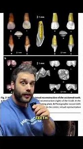 The First Blue Eyed Human (That We Know Of) #evolution #learning #history #biology #archaeology