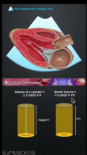 Velocity Time Integral (VTI)