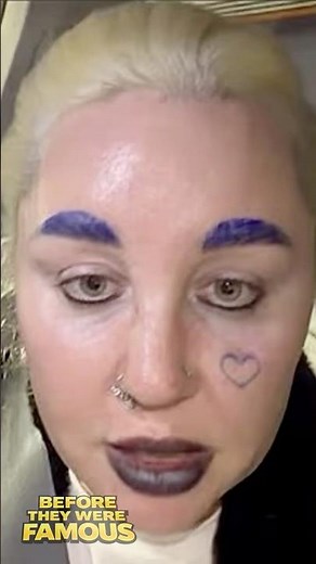 WTF Happened To Amanda Bynes Face?