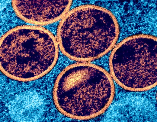 Scientists Monitor the Concerning Spread & Evolution of Mpox | Microbiology