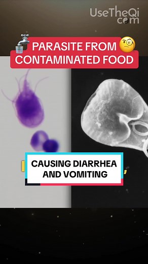 Giardia intestinalis – an oldie but a goodie. It doesn't discriminate – affecting humans, cats, dogs, and birds. Infection from contaminated food or water leads to fatigue, foul-smelling gas, diarrhea, and vomiting. But after a week, the parasite usually departs. #parasite #contaminatedfood #rawfood #worm #tapeworm #water #parasiteawareness #qicoil @David Wong ⭐️ Frequency Expert