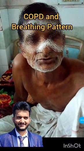 COPD #breathing pattern in Copd #respiration #shorts #asthma #health