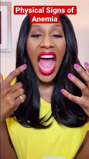 Physical Signs of Anemia🩸! A Doctor Explains #shorts