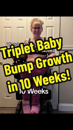 Triplet Baby Bump Growth - Watch my Journey Over 10 Weeks!