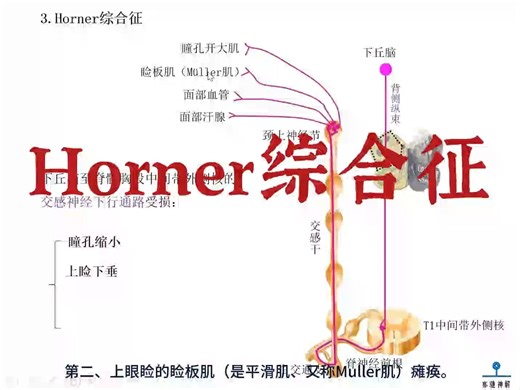 神经解剖学-山路老师：Horner综合征