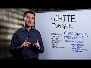 What Causes White Tongue? – Dr.Berg on Oral Candidiasis